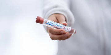 PGR pone bajo cuidado médico a 76 privados afectados por Covid-19