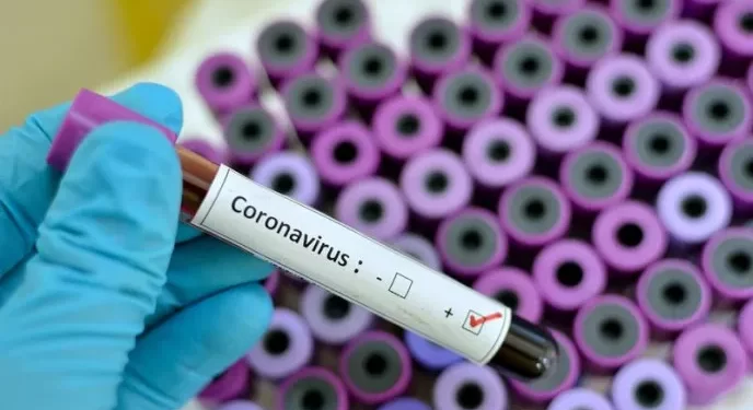 RD acumula 323 casos activos de COVID-19 y 4,376 muertes por la enfermedad