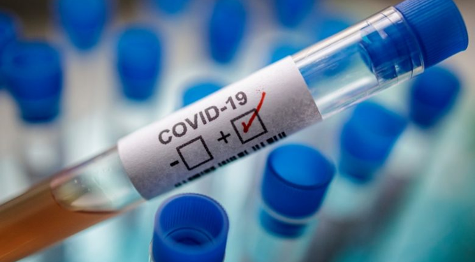 Salud Pública reporta 20 personas hospitalizadas por COVID-19 en el país